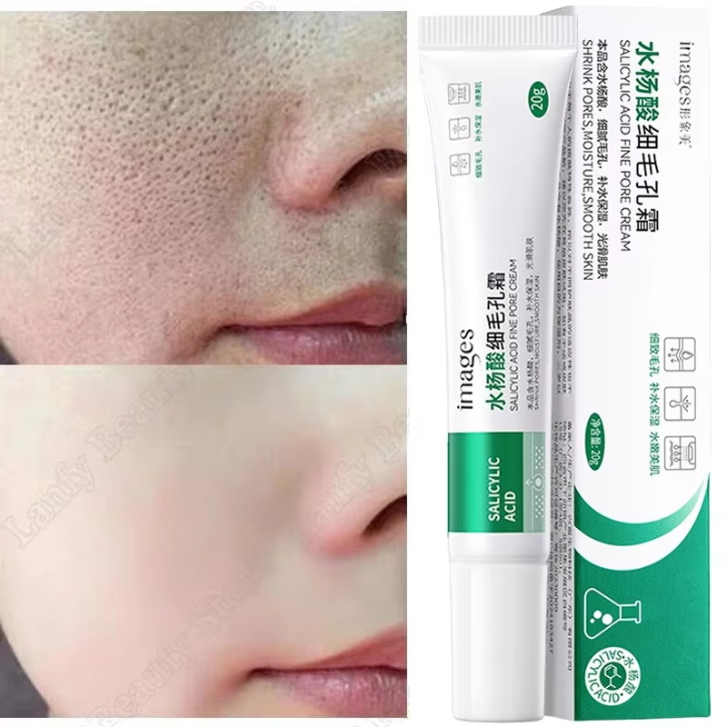 Salicylic Acid Blackhead Remover - Salisilik Asit Gözenek Temizleme Kremi Gözenekleri