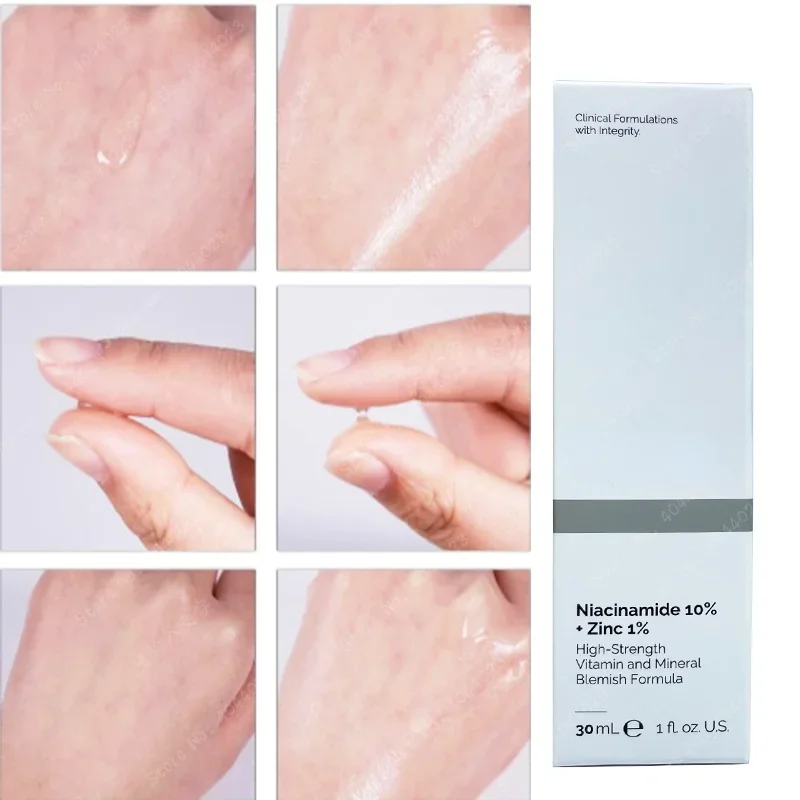 Niasinamid Magnezyum Beyazlatı - Niacinamide Pore Shrinking Essence incelemesi ve fiyatı