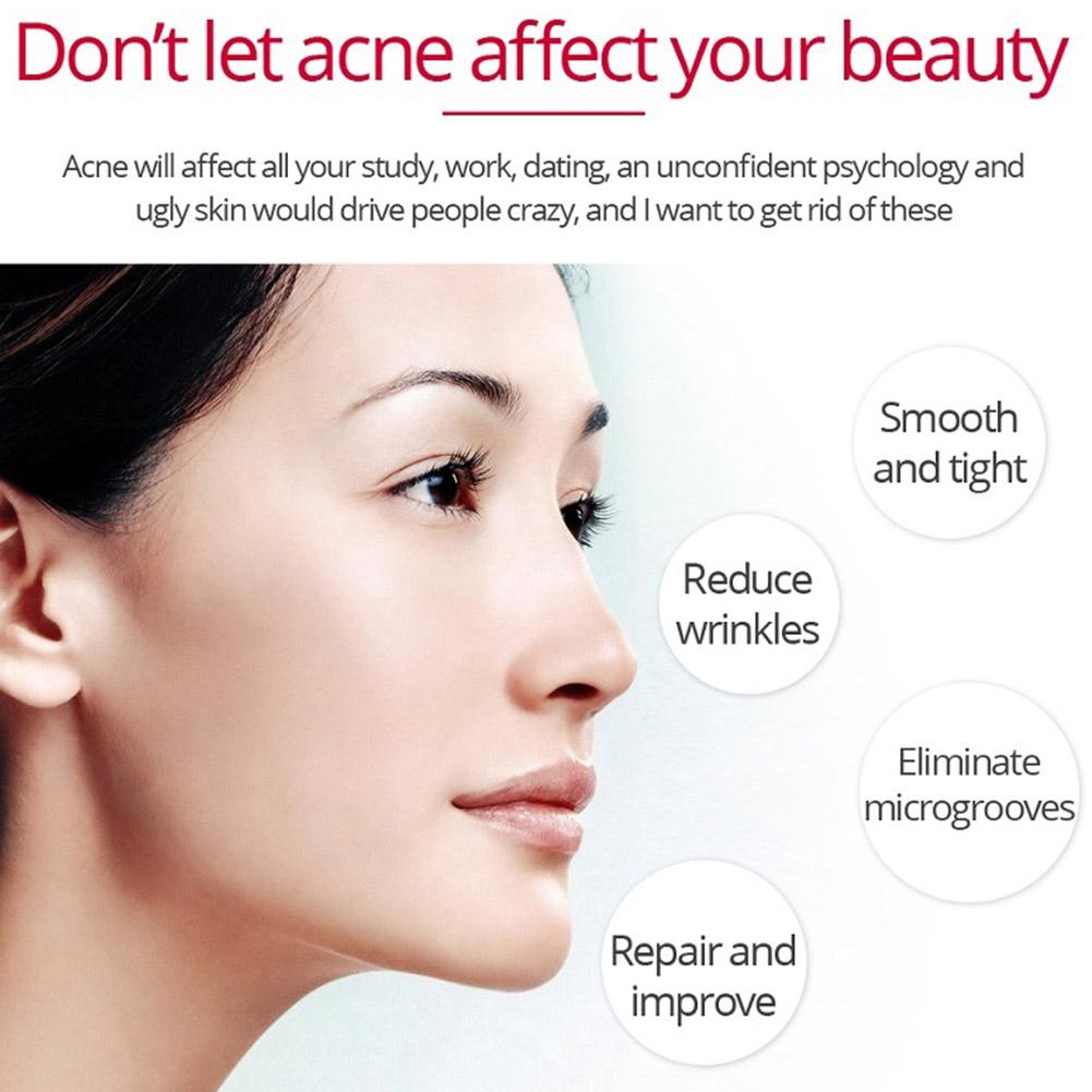 Retinol kaldırma sıkılaştırıcı - Retinol Anti Wrinkle Cream incelemesi ve fiyatı